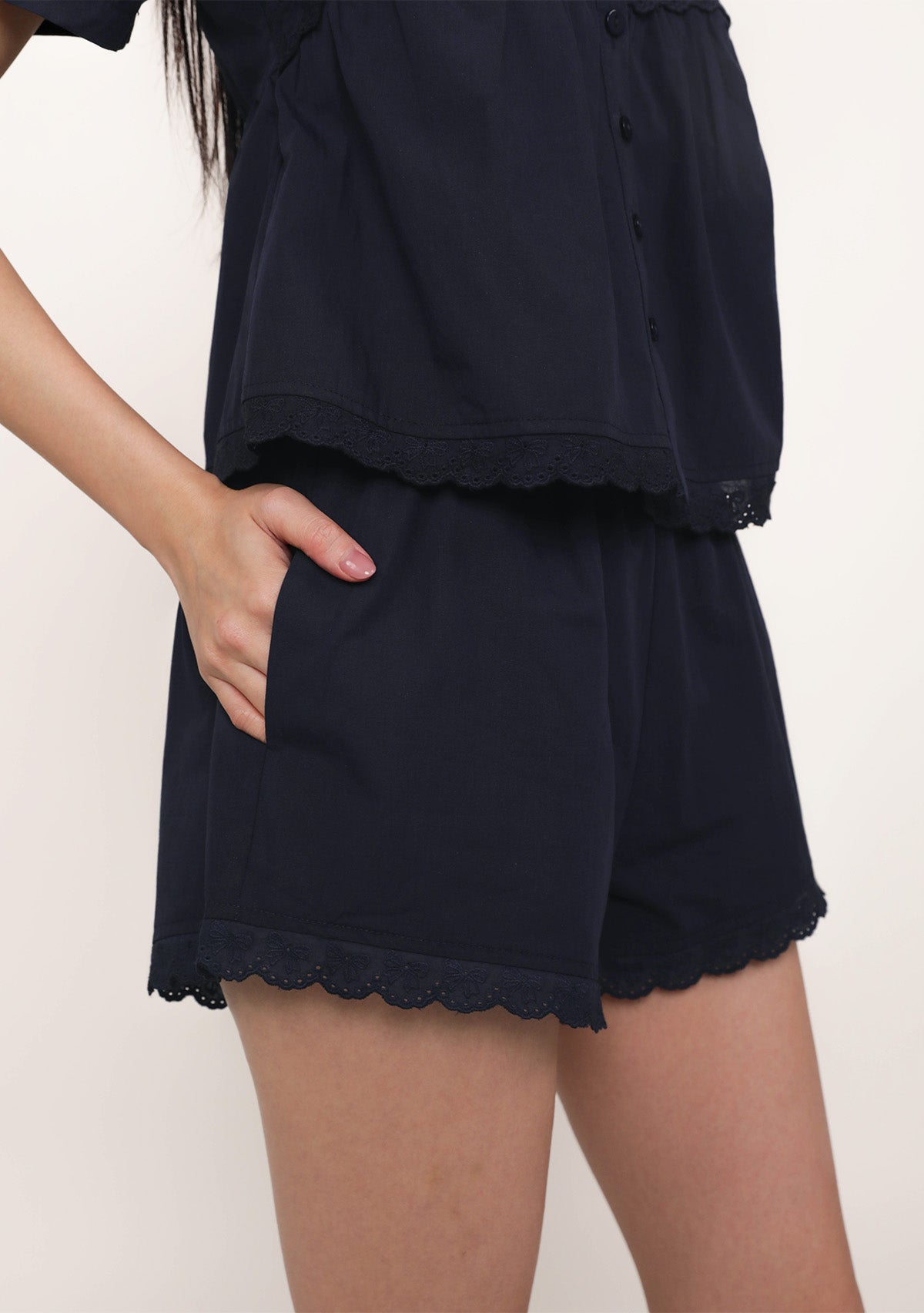 ETA EARLY JUN] BACKORDER Savina Lace Trim Shorts – The Tinsel Rack